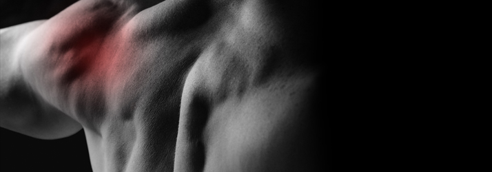 Chiropractie Geldermalsen GW Rotator Cuff Syndroom Chiropractie Geldermalsen GW Rotator Cuff Syndroom